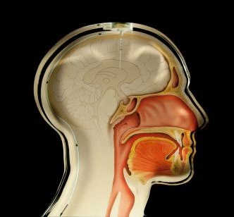 Hydrocephalus sensor